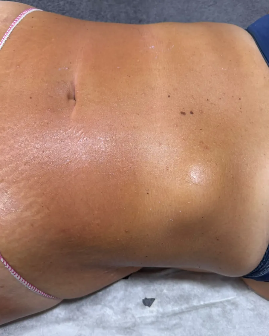 Massagem redutora